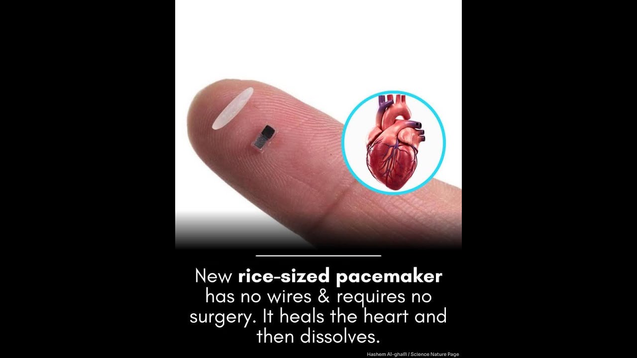 💡 Tiny Dissolvable Pacemaker Could Save Newborns 👶 Lives &ndash; No Surgery Needed | Rice-Sized Pacemaker