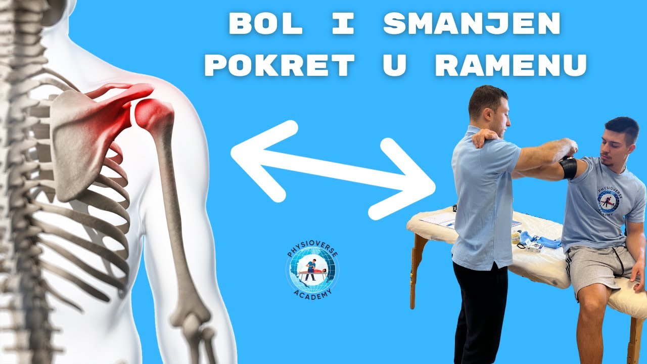 BRZA i PRECIZNA terapija Smrznutog ramena | Smart Flossing tečaj