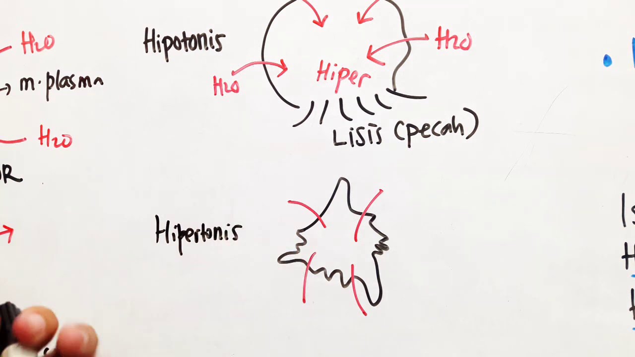 OSMOSIS : Turgor, Plasmolisis, Krenasi, Lisis