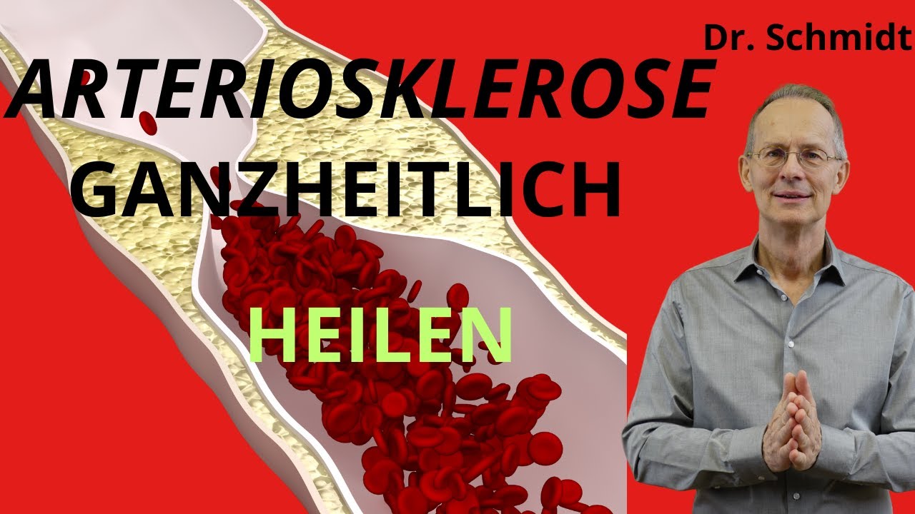Arteriosklerose: Diagnostik + ganzheitliche Therapie. Heilung ist möglich.