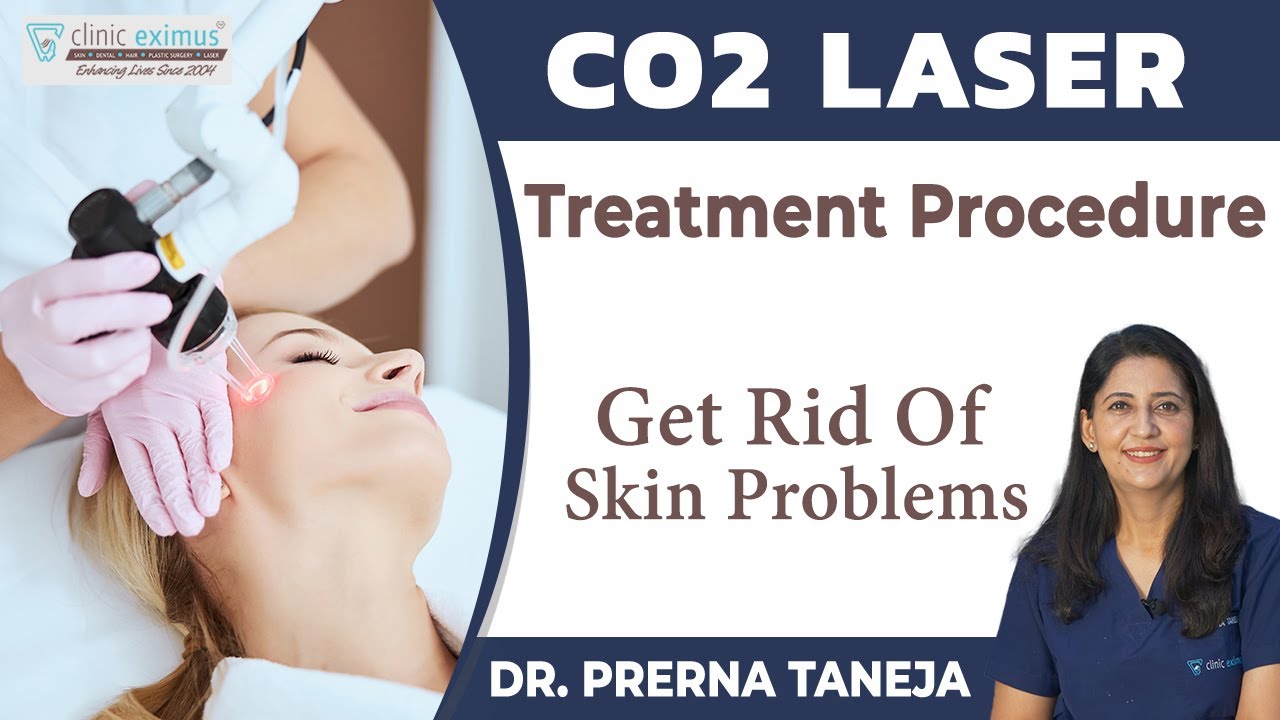 CO2 Laser Skin Treatment For Acne Scars, Procedure | किनको लेज़र की जरूरत है | जाने सभी सवालो के जवाब