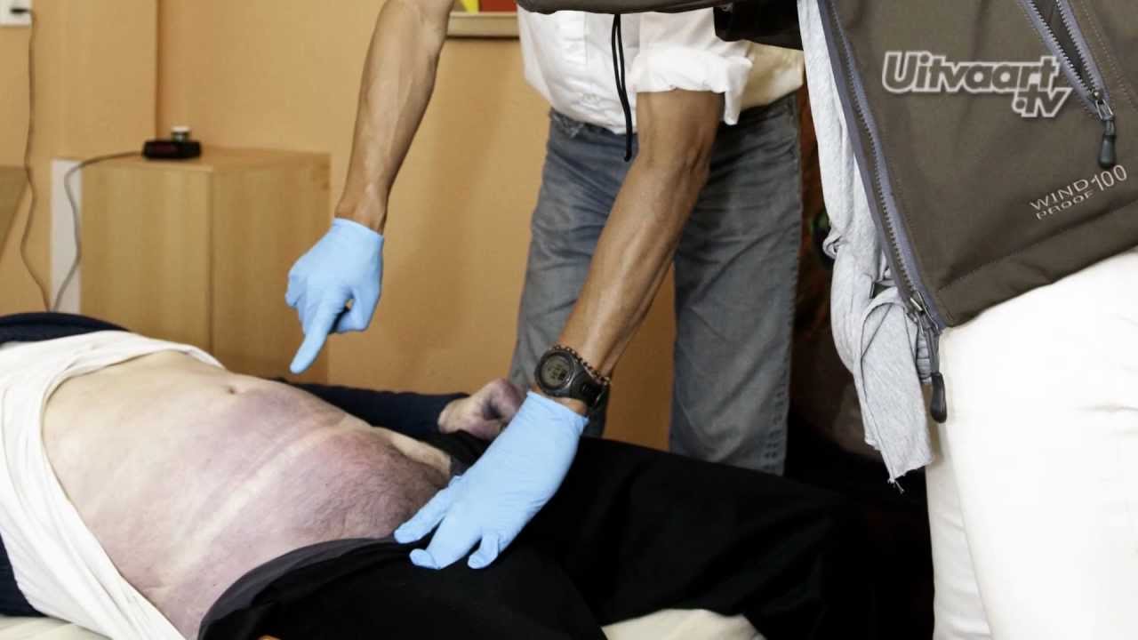 Vrijgeven van een lichaam