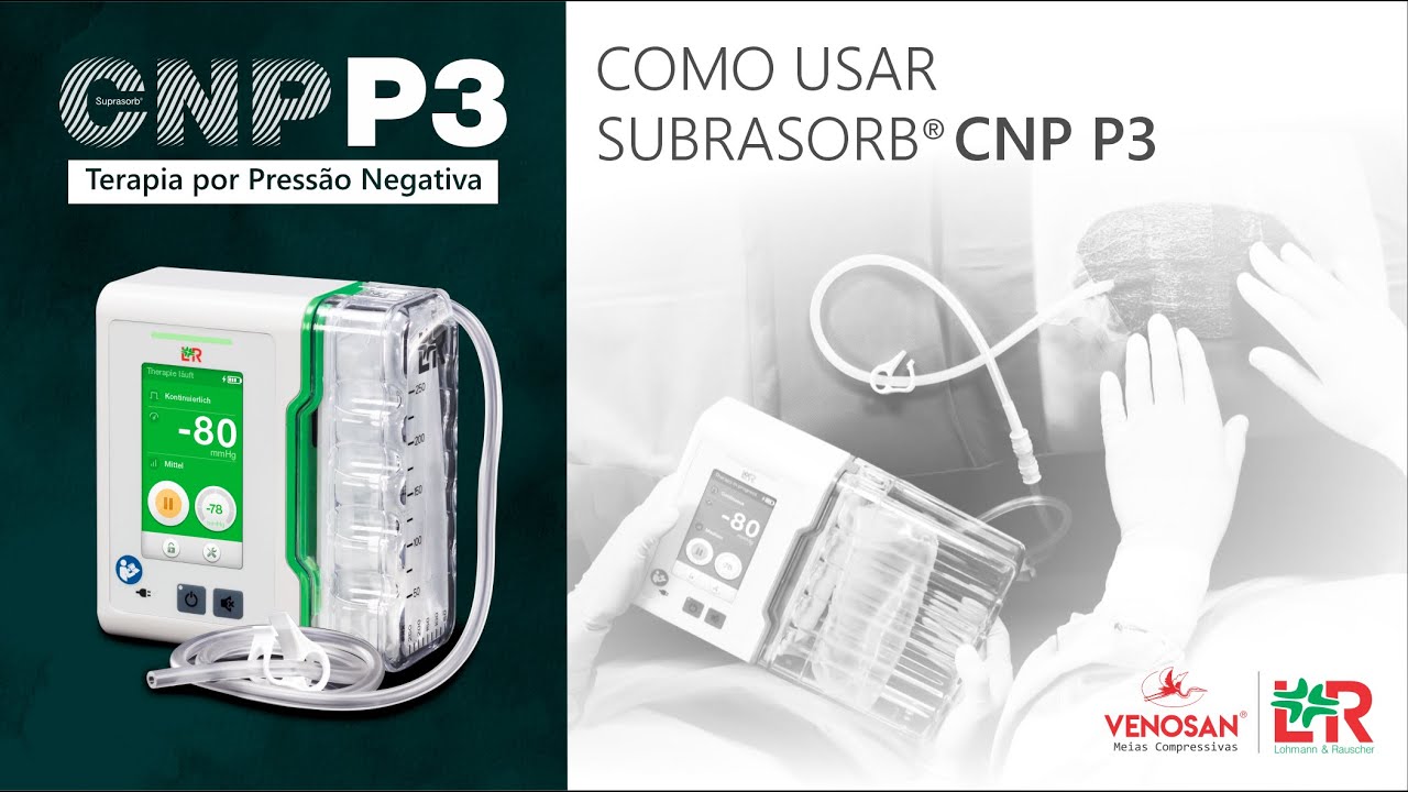 CNP P3  - TERAPIA POR PRESSÃO NEGATIVA - COMO USAR?