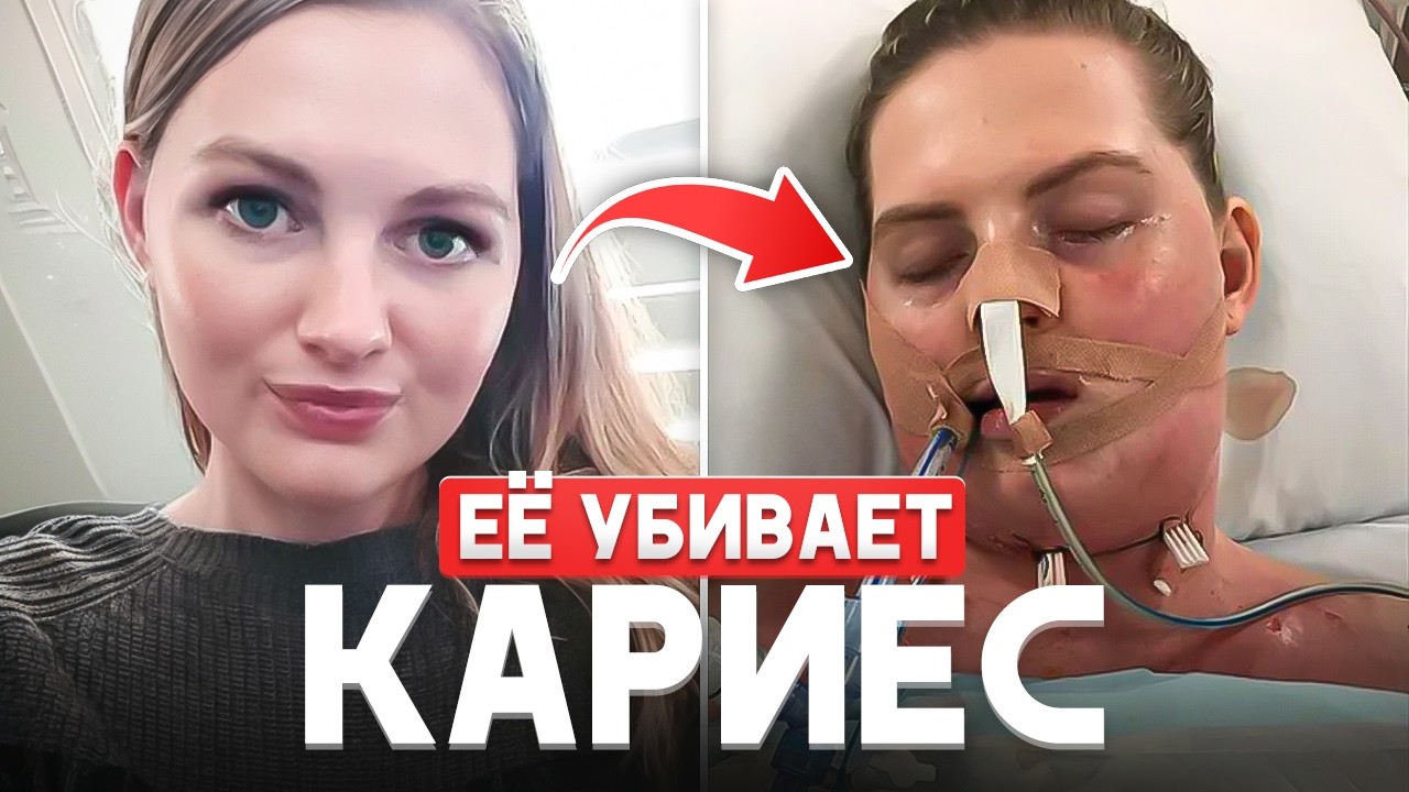 Смертельный КАРИЕС. Реальные Истории и Последствия