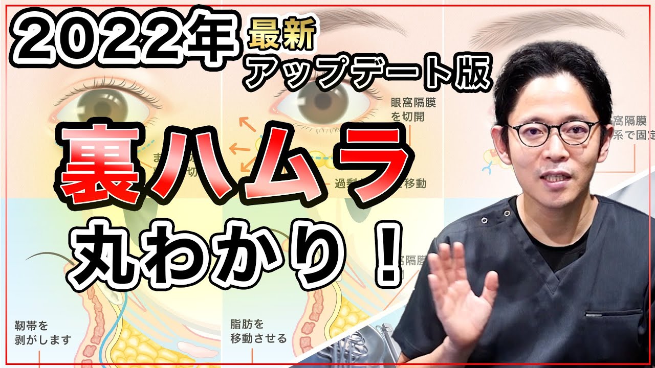 【2022年最新アップデート】裏ハムラ総論