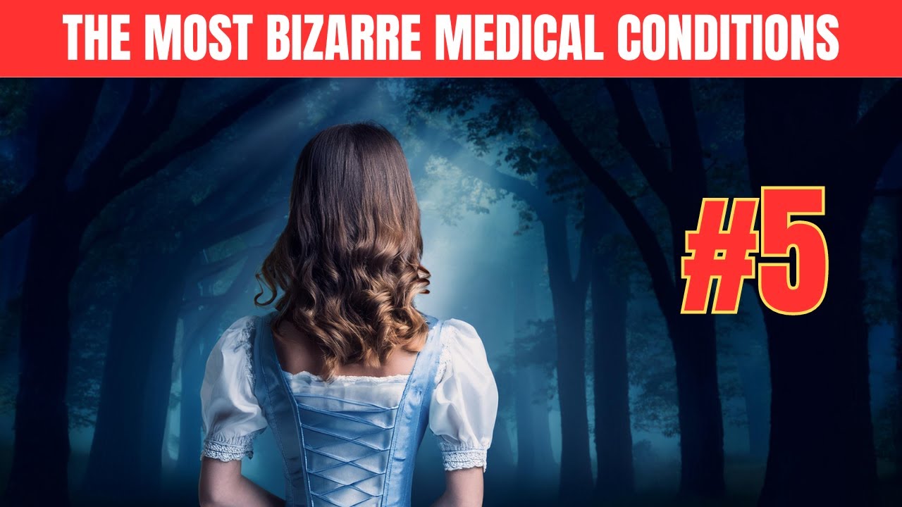Top 10 World's MOST BIZARRE Medical Conditions | Number 5