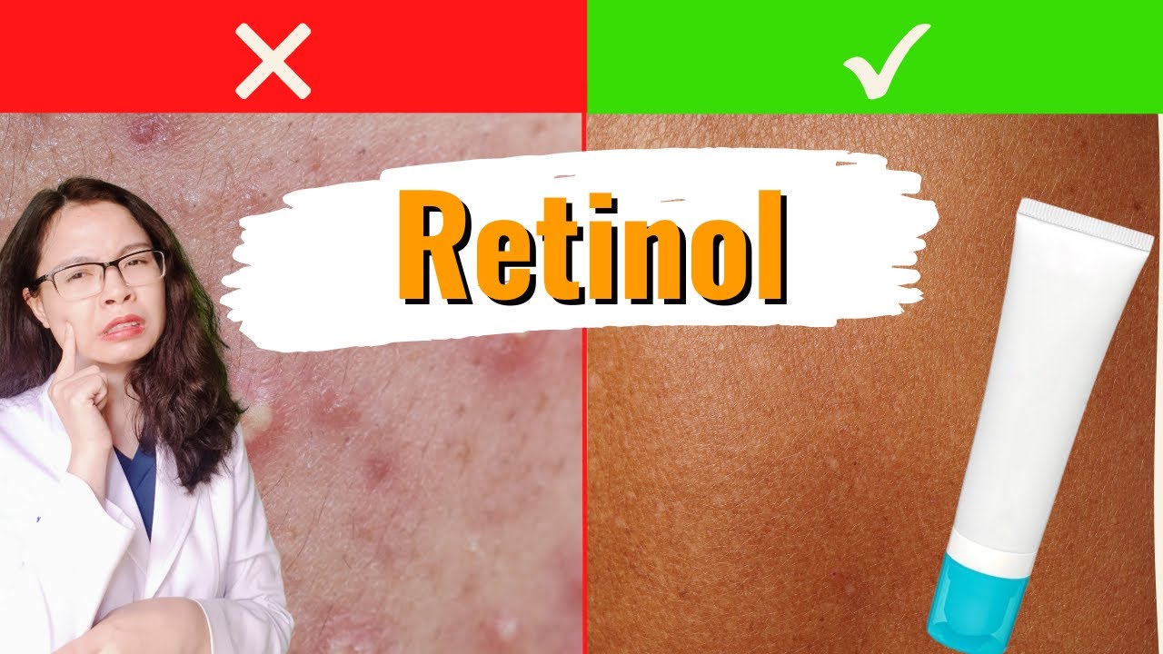 Dùng retinol đúng cách để không bị sạm da - nổi mụn - rát da - bong da - Bác sĩ Nguyên