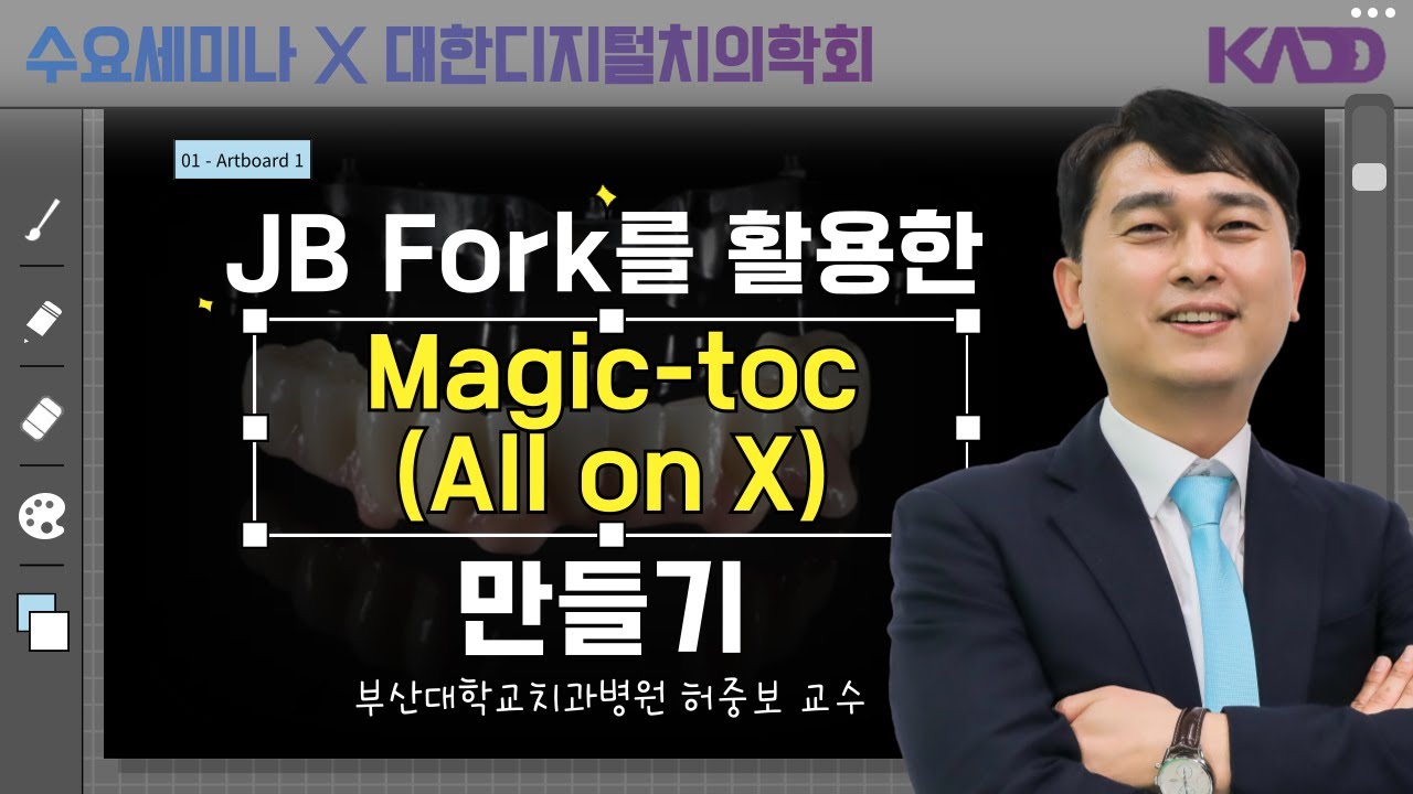 [디지털치의학회] JB Fork를 활용한 Magic-toc (All on X) 보철 치료