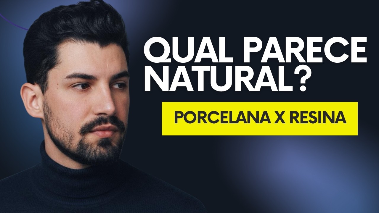 TUDO que você precisa saber antes de colocar LENTES! Qual é MELHOR?