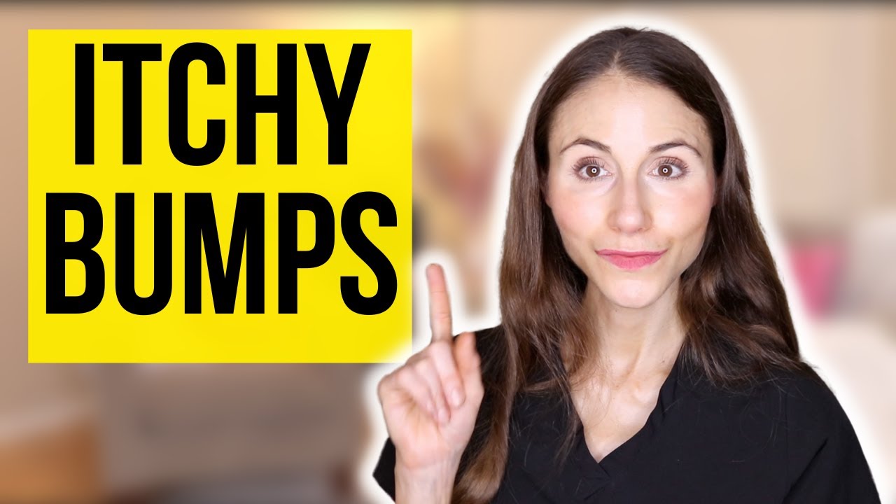 Itchy Bumps On The Skin | Prurigo Nodularis Explained