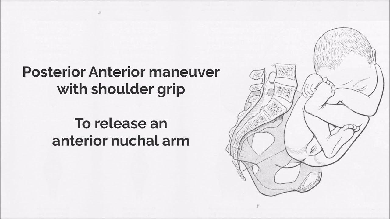 Front to back breech maneuver