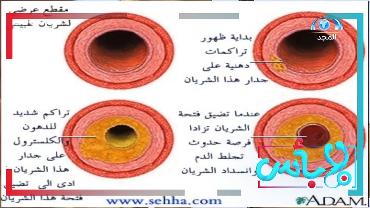 كيف يتم استخدام الأوزون الطبي في علاج الجلطات والأوعية الدموية؟