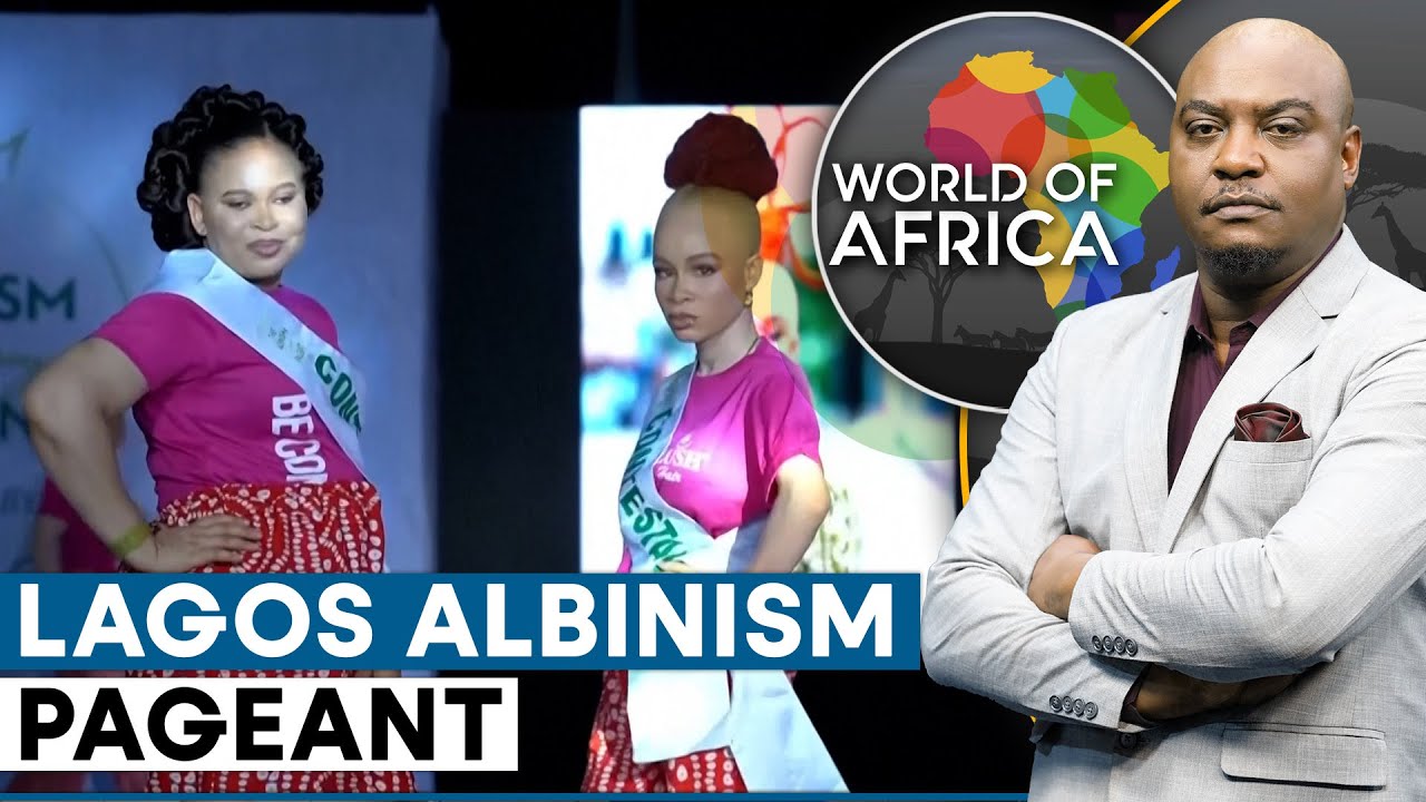 Nigeria’s Albinism Community Gets Its First Beauty Queen In Lagos | World Of Africa