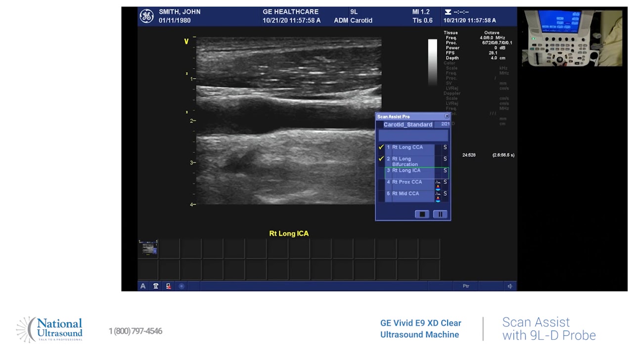 GE Vivid E9 XD Clear Scan Assist with 9L D Probe Training Video