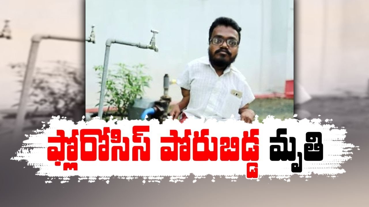 Fluorosis Vicitm Amshala Swamy Passes Away | At Nalgonda | ఫ్లోరోసిస్ బాధితుడు అంశాల స్వామి మృతి