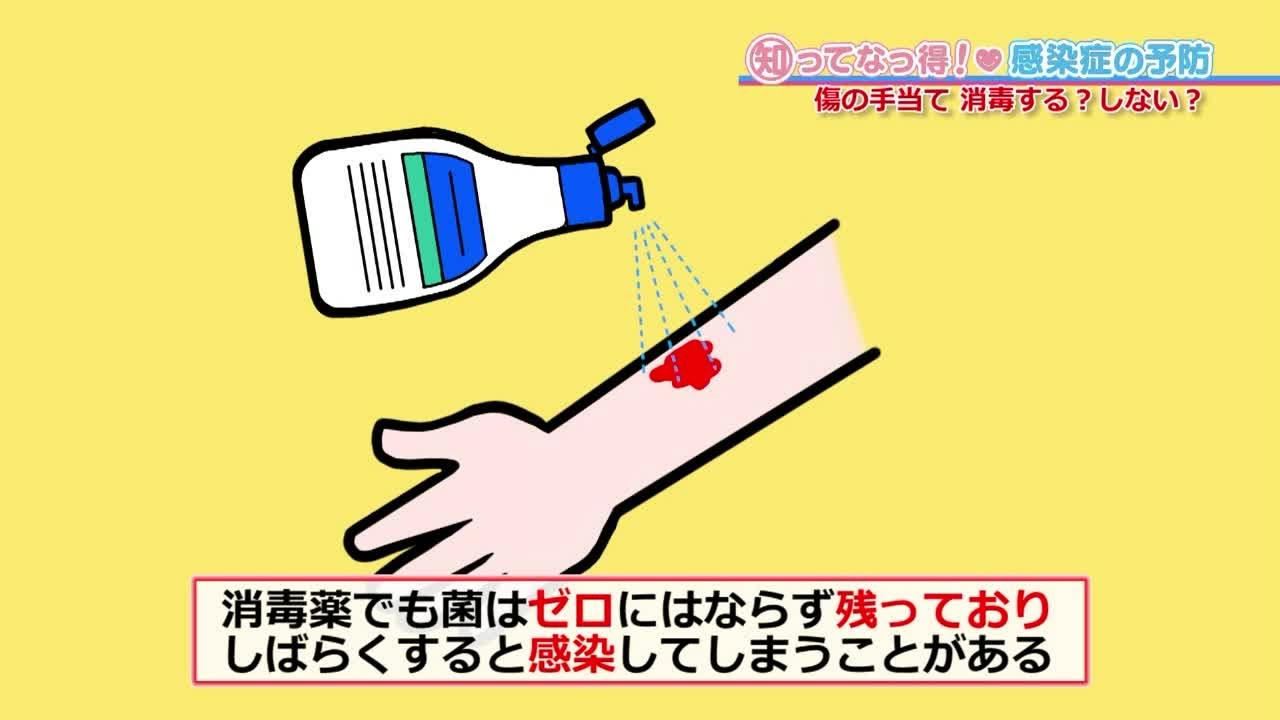 【すり傷など】傷の手当て「知ってなっ得！感染症の予防＃８その５」