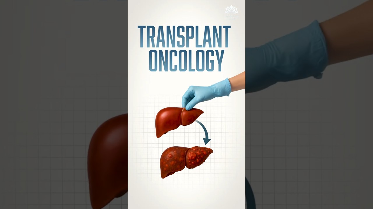 Treating Rare Abdominal Cancers through Intestinal & Multivisceral Transplantation #globalhealthcare