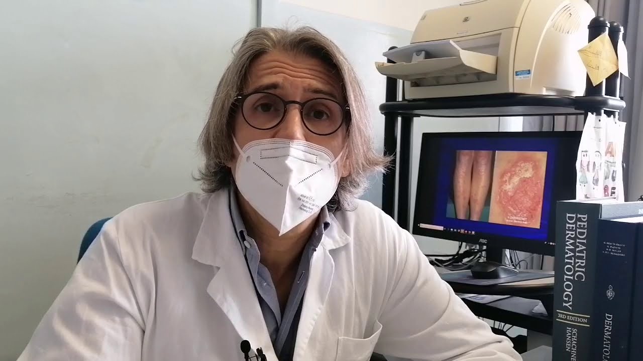 Cultura é Cura: psoriasi, sintomi e trattamenti