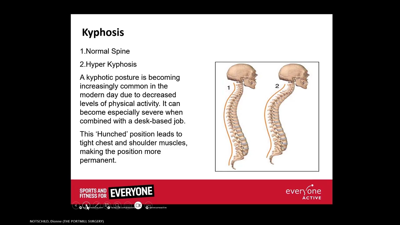 Men's Health Series - Musculoskeletal Issues