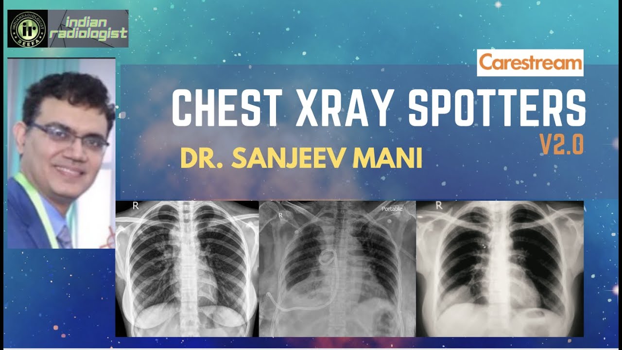XRAY CHEST SPOTTERS  - V2.0 || DR SANJEEV MANI || EXAM CASES ||