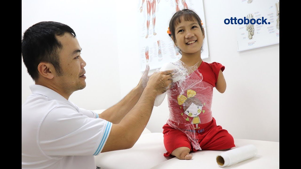 Hành trình lắp chân tay giả của bé Hiếu Thảo | Ottobock