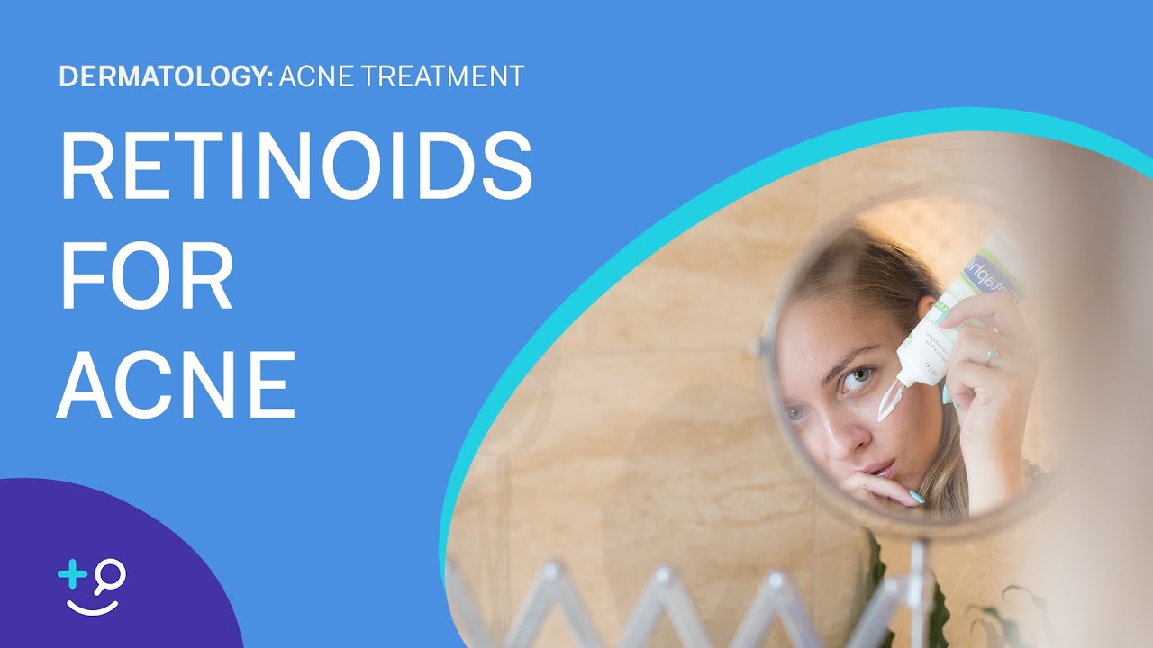 Retinoids for Acne [Acne Treatment]