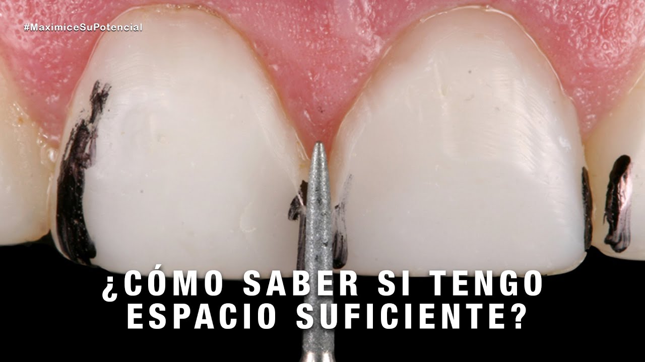 Mecanismos para tener un control de las preparaciones | #MaximiceSuPotencial | Milko Villarroel