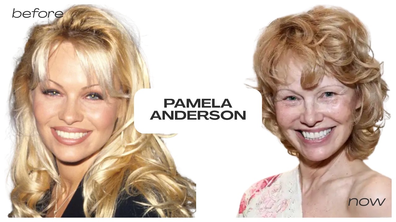 Pamela Anderson: From Baywatch Icon to Her Life Today