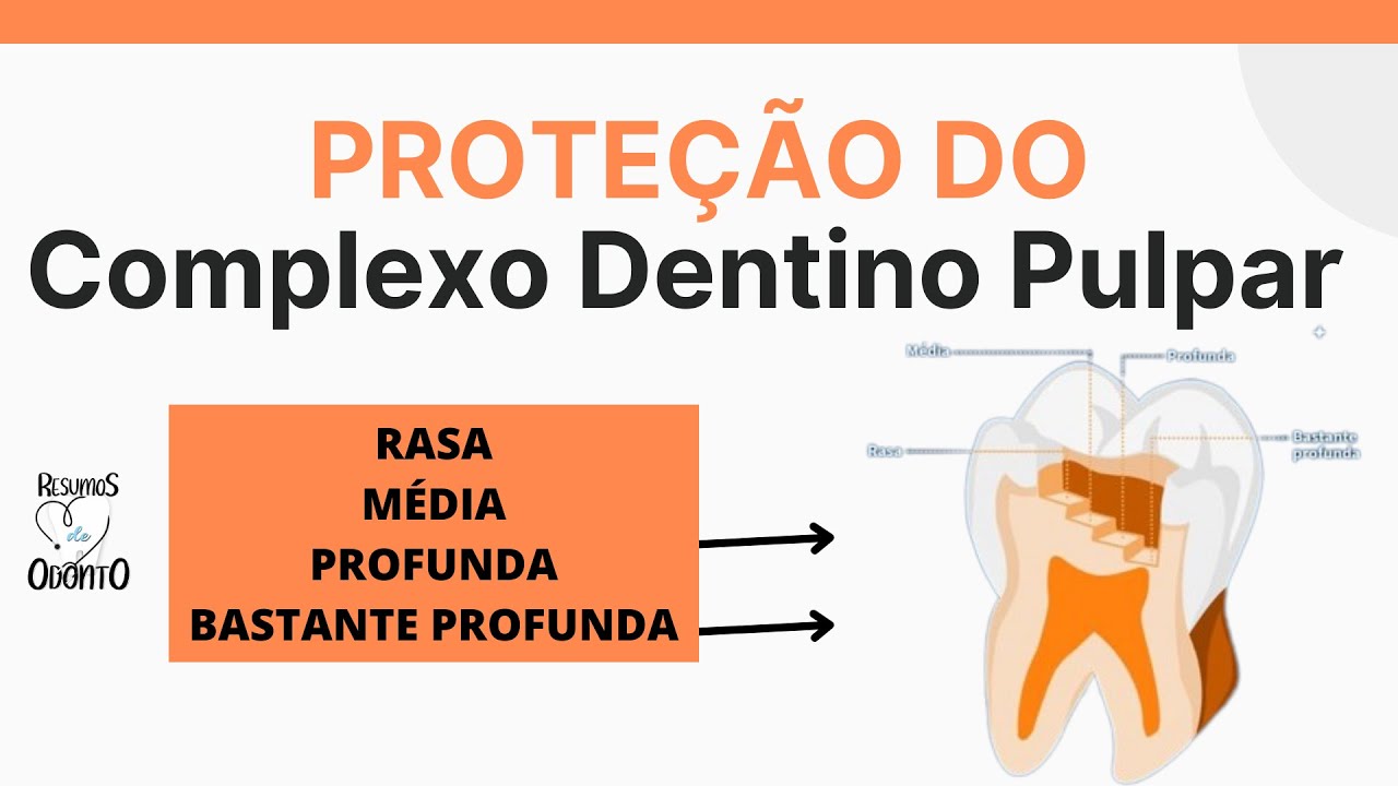 CAPEAMENTO PULPAR DIRETO VS INDIRETO