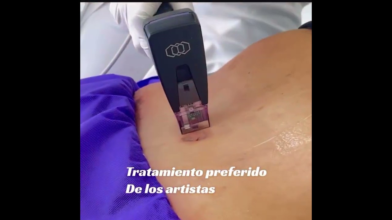 MORPHEUS 8 ve el resultado al final del video ( antes y después )