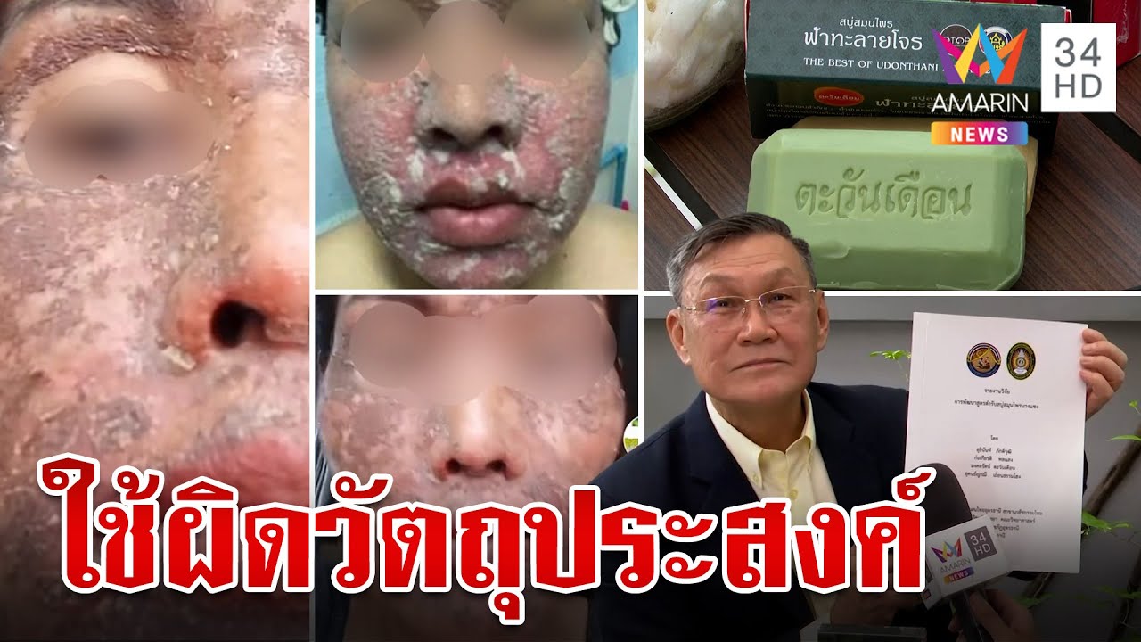 เจ้าของโร่แจง สบู่นางแซงถูกรีวิวใช้ผิดวิธี อย.เตือนอย่าหลงเชื่อสรรพคุณเกินจริง |ทุบโต๊ะข่าว|22/10/66