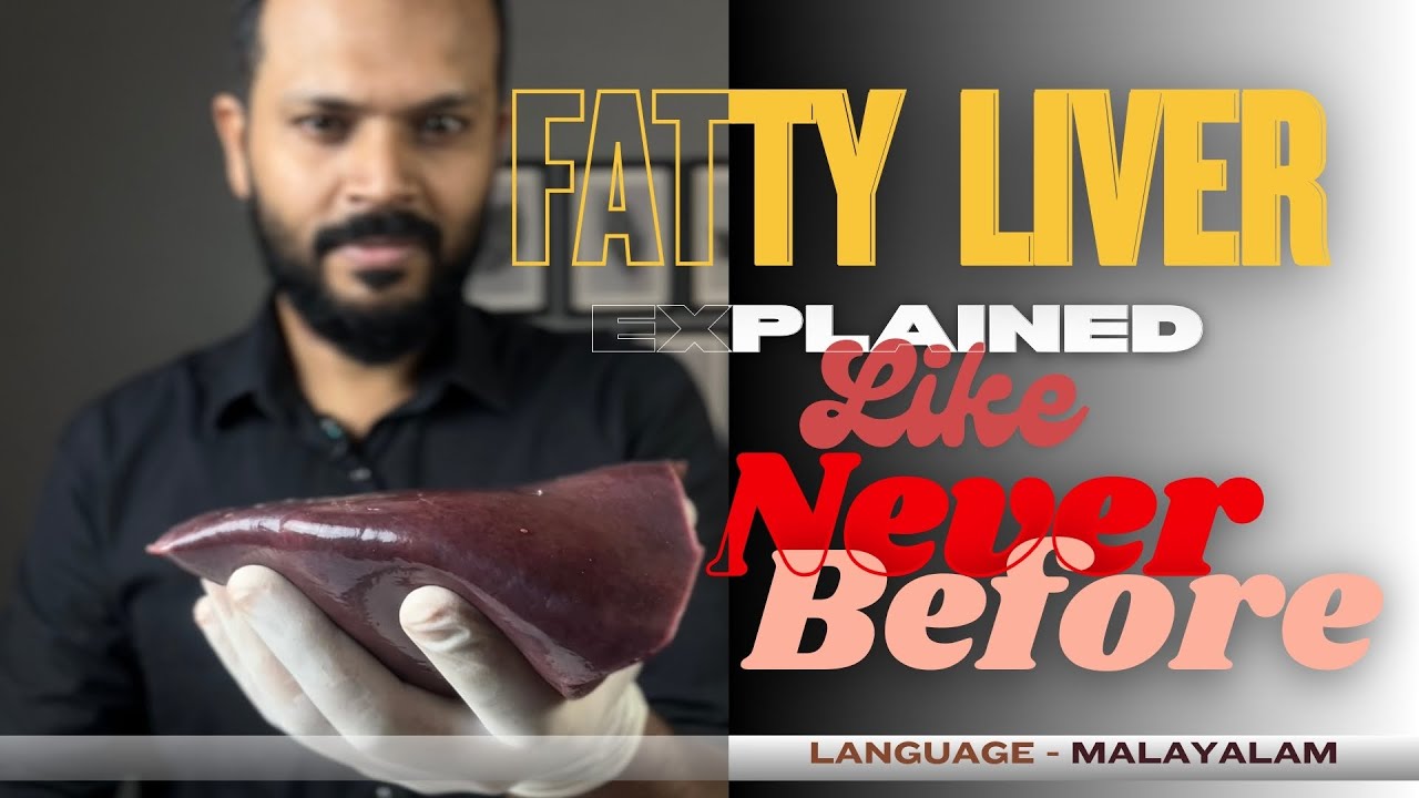 FATTY LIVER EXPLAINED LIKE NEVER BEFORE