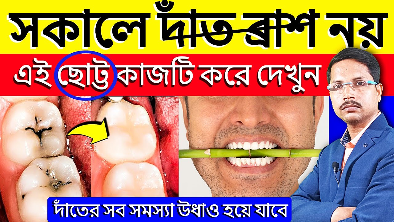 ✨এই ছোট্ট কাজটি সকালে করুন দাঁতের সব রোগ এমনি উধাও হয়ে যাবে ✅ Teeth Diseases Treatment |