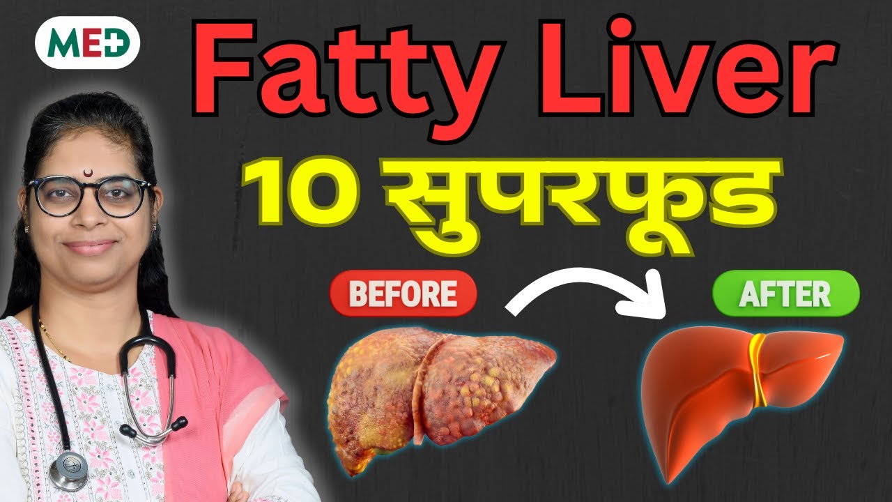 Top 10 Superfoods for Liver I लीवर के लिए 10 बेस्ट सुपरफूड्स I #liver #health #food #doctor