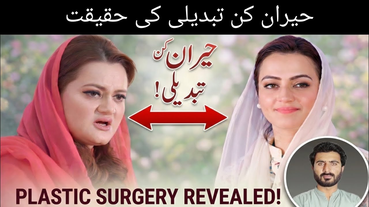 Plastic Surgery Kya Hoti Hai? | Face Beauty Ya Ikhlaaq? | Reality Explained in Urdu