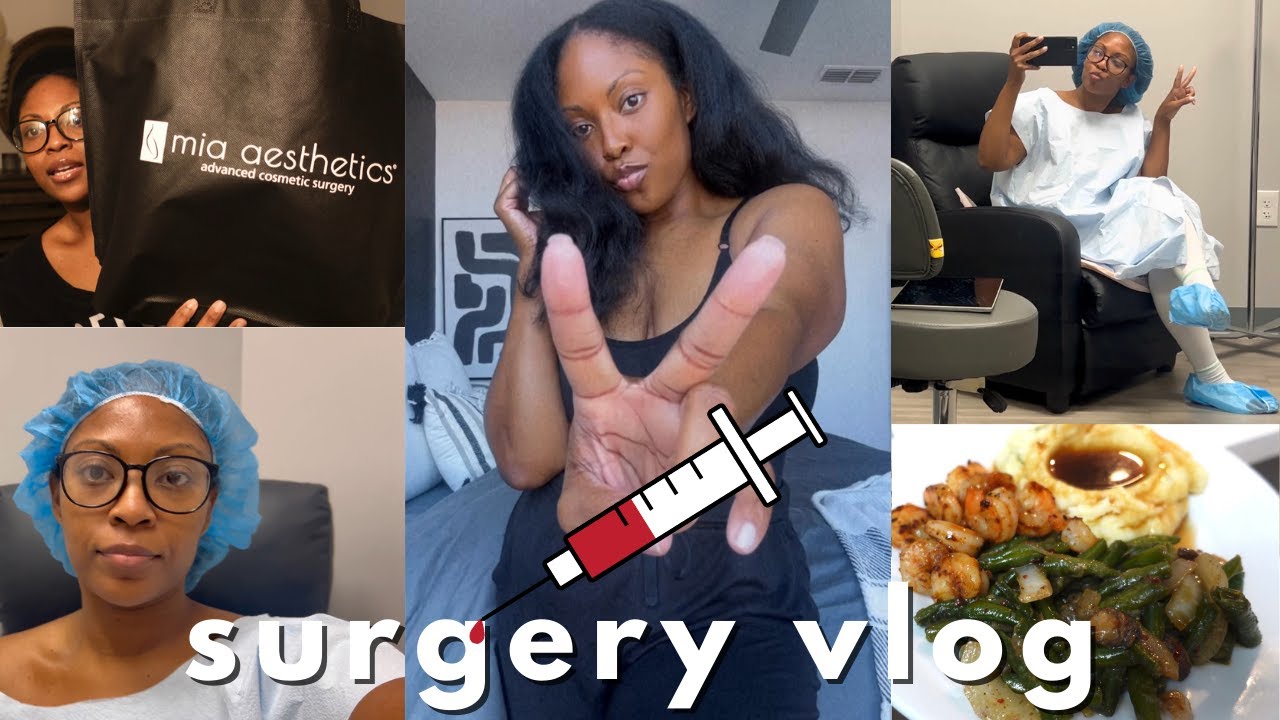 LIPO 360 VLOG! MIA AESTHETICS ATLANTA WITH DR. GRAY! FIRST WEEK POST OPP & I DO NOT LIKE MY RESULTS!