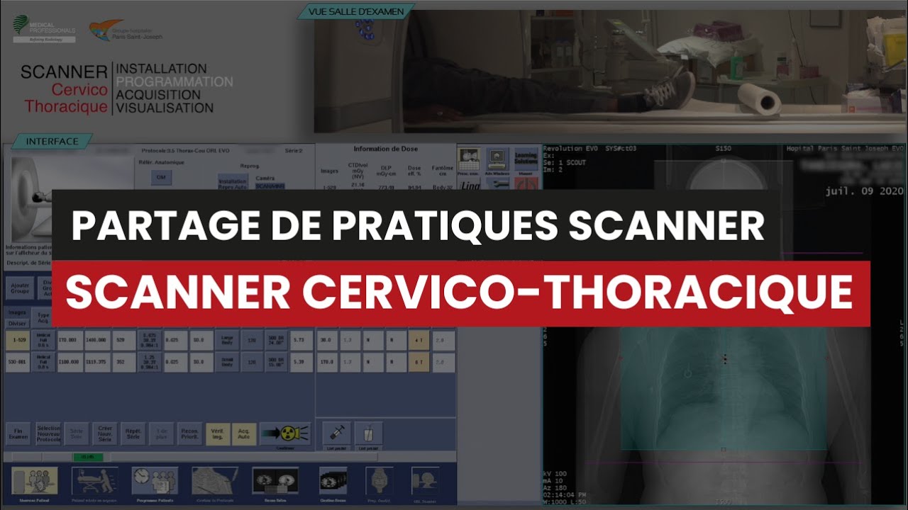 D&eacute;monstration CT Scanner CERVICOTHORACIQUE (inject&eacute;) - partage de pratique