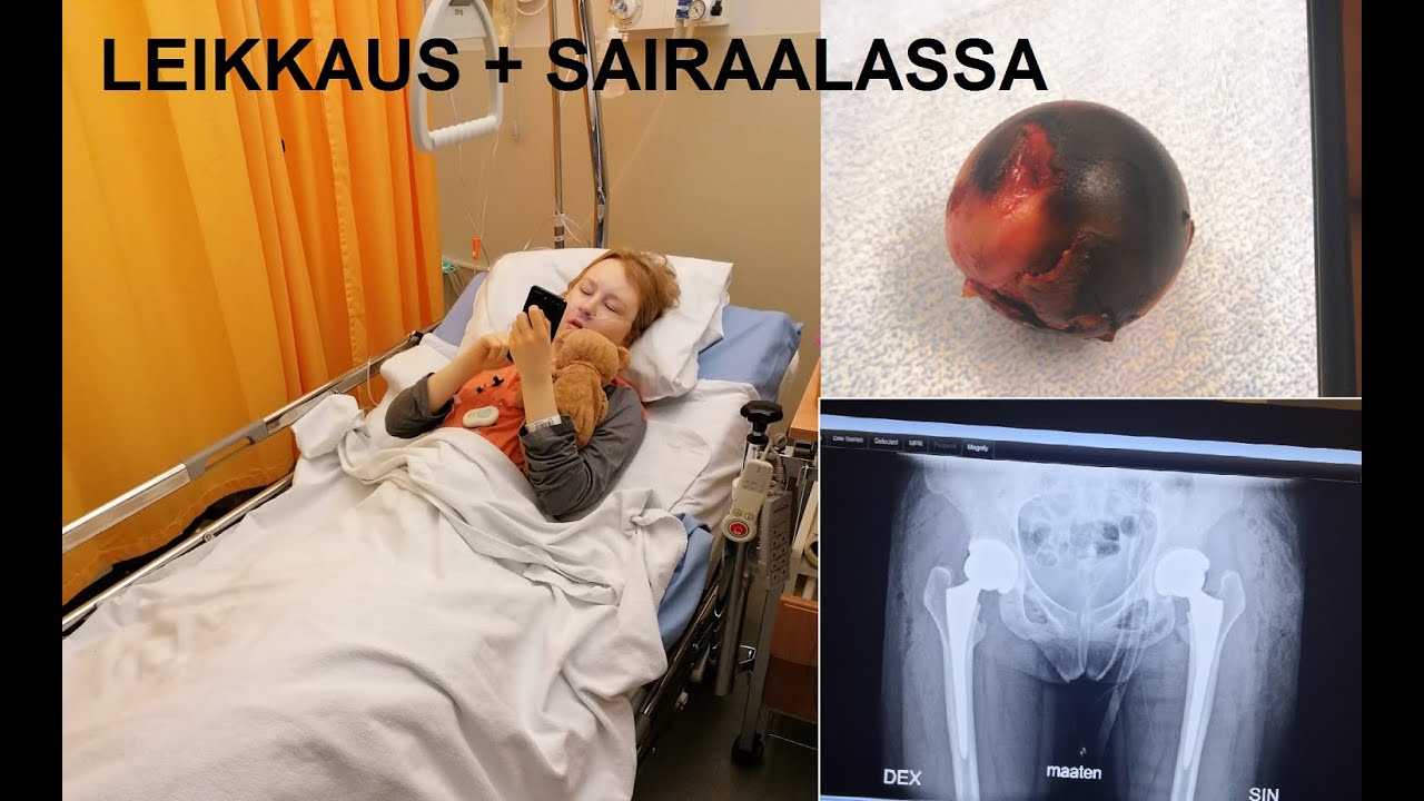 Lonkkien tekonivelleikkaus osa 2 | Lotta