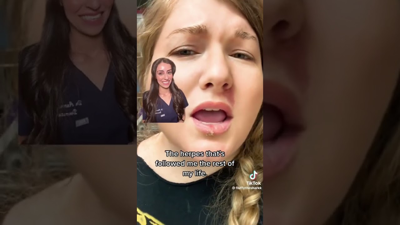 HERPES on your LIPSTICK?! 💄 🤯 | Dr Adel#shorts