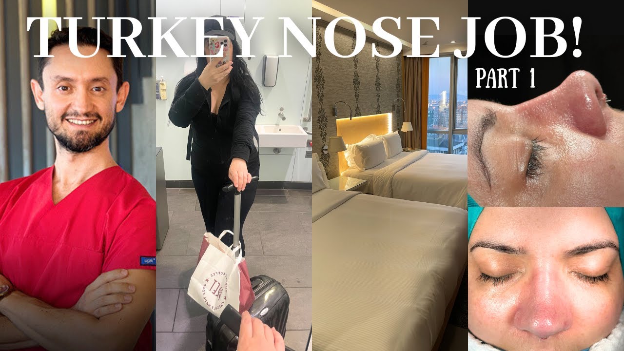 RHINOPLASTY WITH THE BEST SURGEON IN TURKEY DR YUSUF ORHAN UÇAL & CLINICHUB travel day & hotel day!!