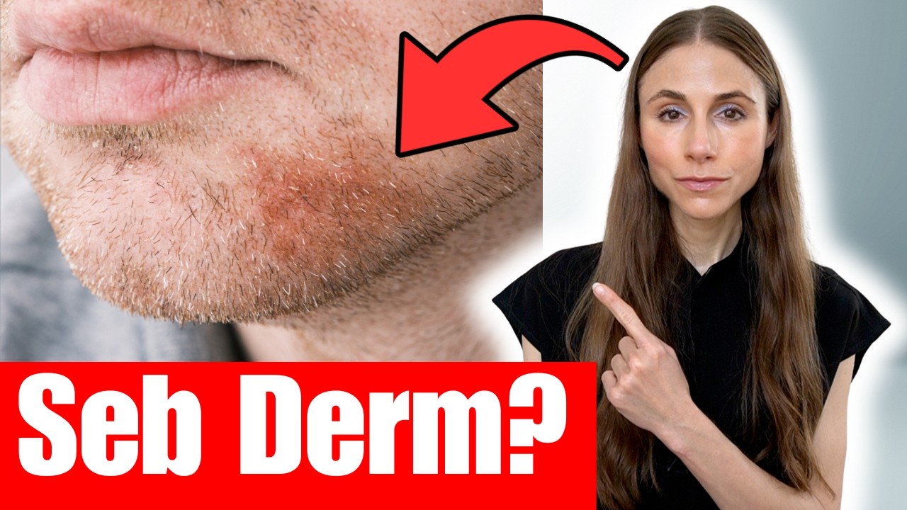 Дерматолог объясняет, как лечить себорейный дерматит (перхоть, шелушение кожи головы, бровей и бо...