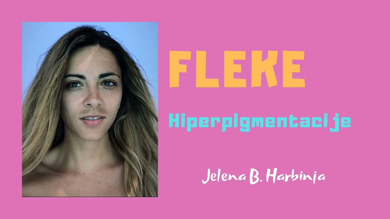 Hiperpigmentacije! Kako se riješiti fleka na licu? Jelena Blagojević Harbinja