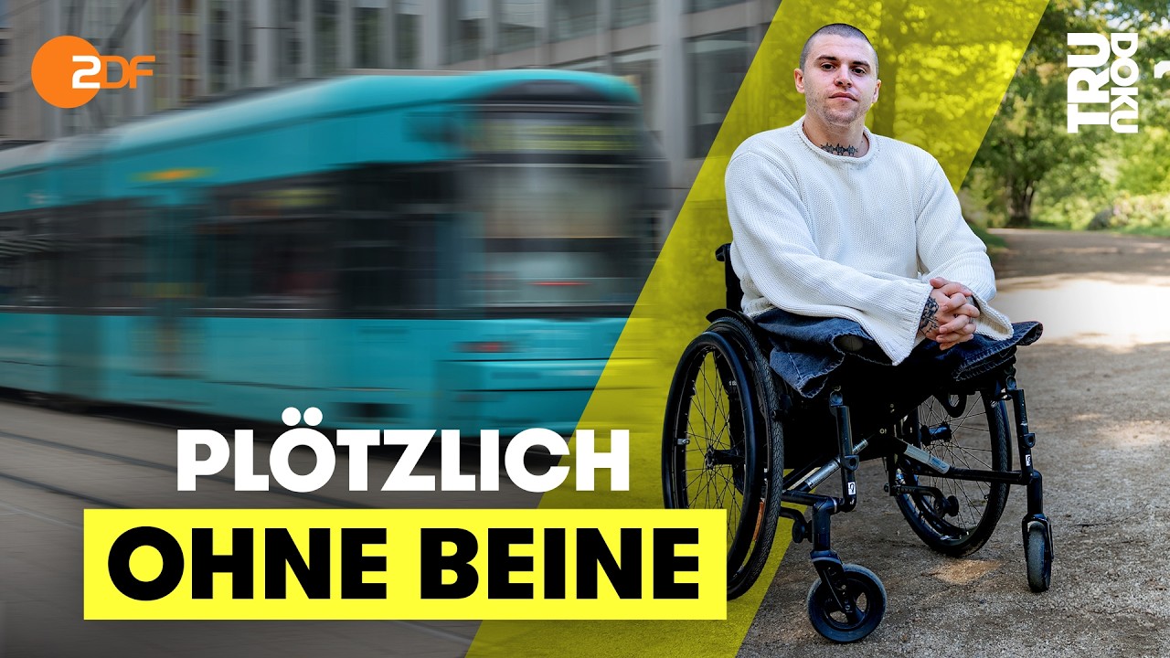 Alex (31) hat einen Stra&szlig;enbahnunfall &uuml;berlebt: &ldquo;Ich dachte, ich sterbe&rdquo; | TRU DOKU