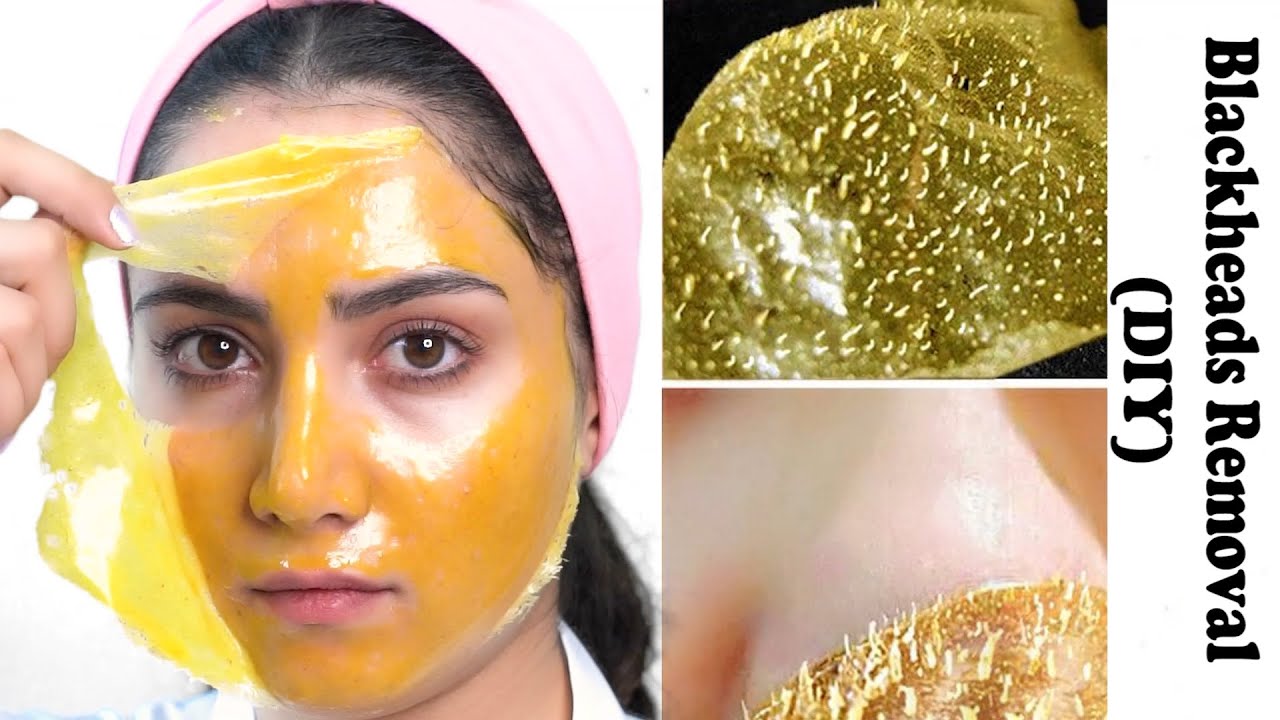 Blackhead And Whitehead Removal With Gelatin Mask Instant