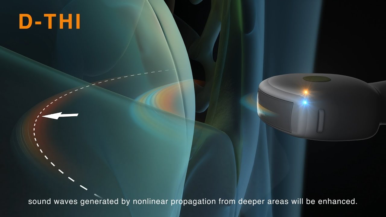 A demonstration of Differential Tissue Harmonic Imaging