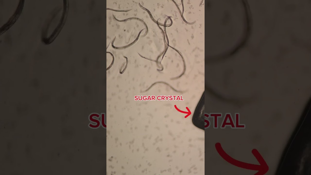 Sugar vs Parasites under the Microscope #health #guthealth #naturalremedies #viralshort