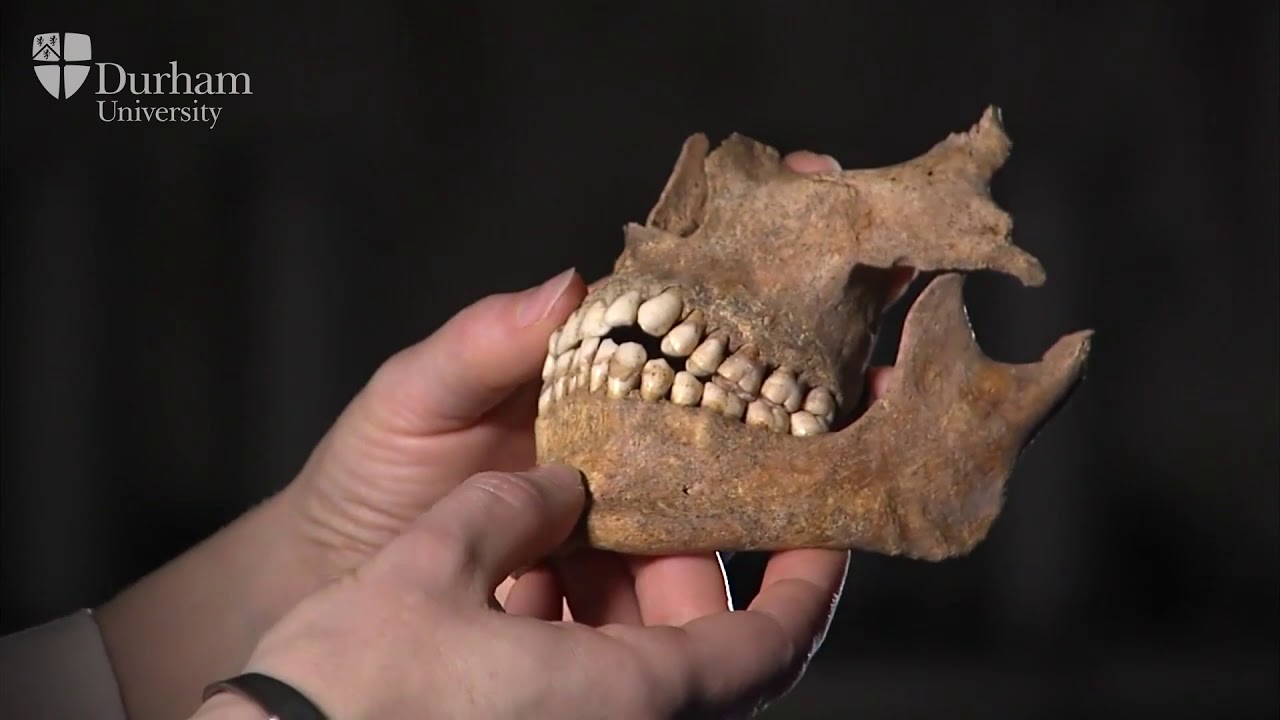Durham Bioarch Bites: Human Osteology and Palaeopathology
