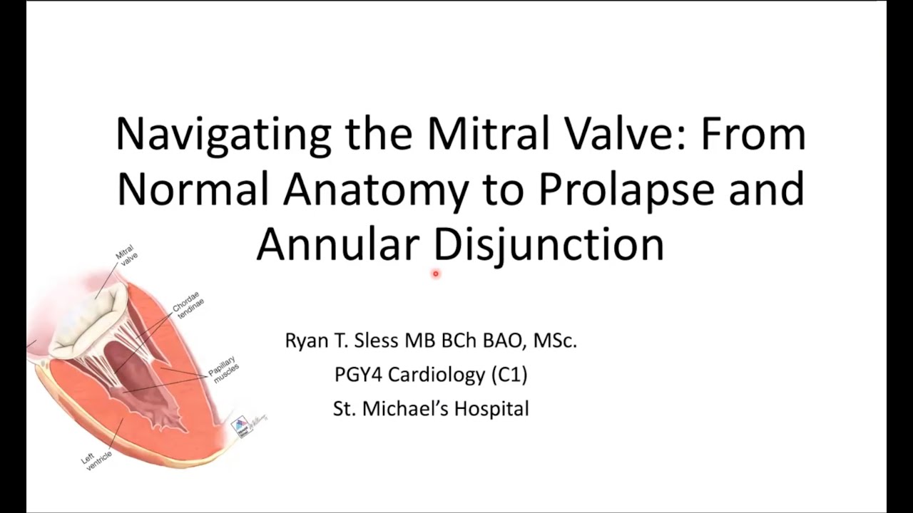 Navigating the Mitral Valve: From Normal Anatomy to Prolapse and Annular Disjunction
