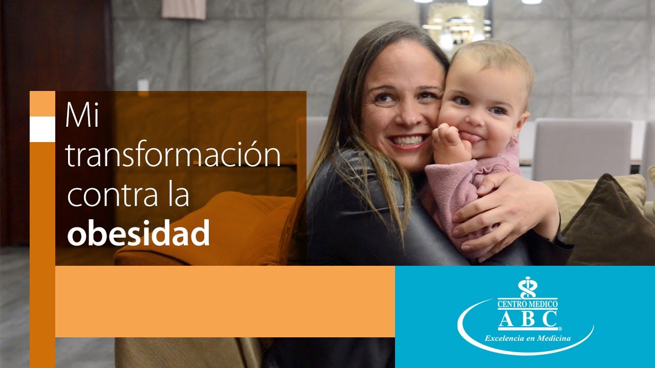 Antes y después - Cirugía bariátrica: testimonio de Ana