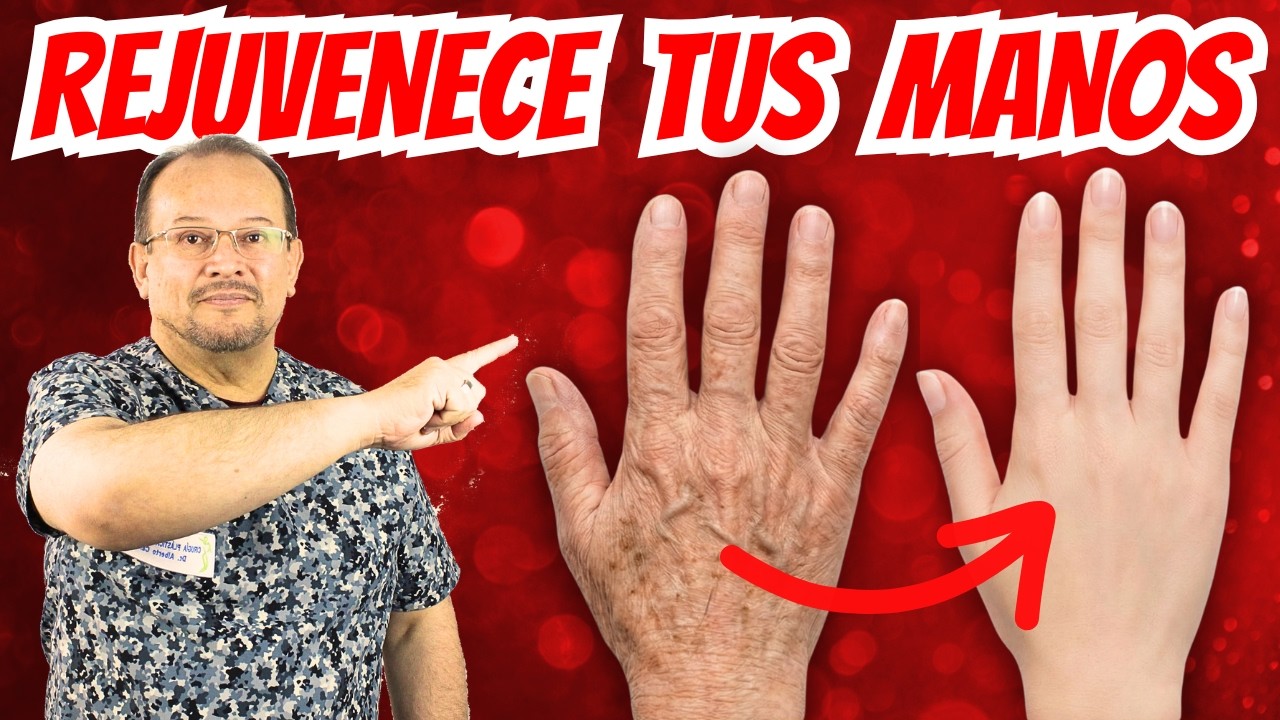 MANOS rejuvenecidas con cirugía plástica / Dr Alberto Calvo